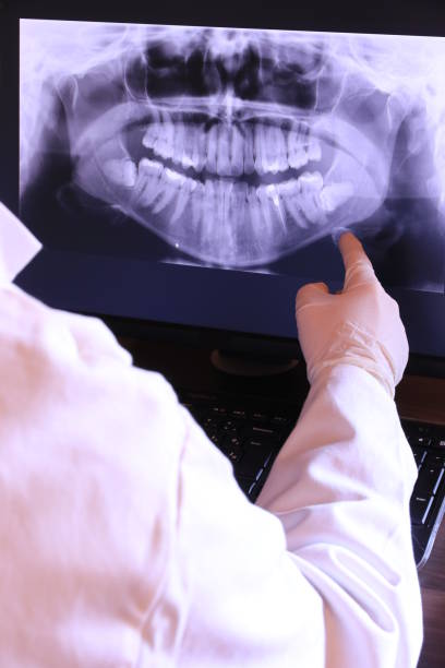 Best Emergency Dentist for Knocked-Out Tooth in Selinsgrove, PA
